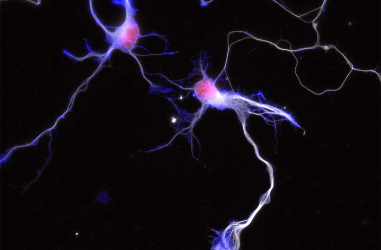 Immunostaining von kultivierten Neuronen (rot: Zellkern; weiß: Tubulin, blau: Aktin)
