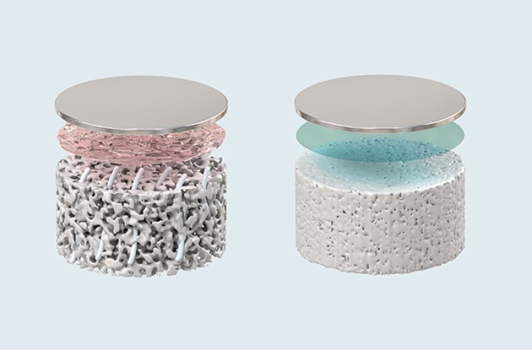 Links: Poröser Festelektrolyt, durch den Li-Dendriten (grau) bis zur...