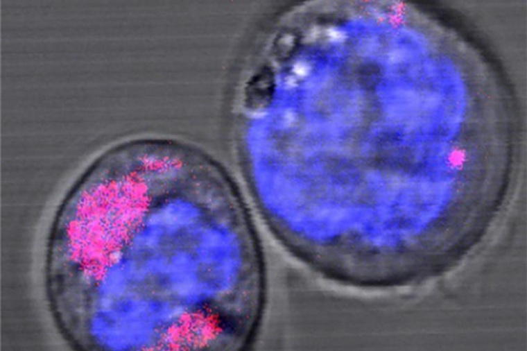 Abb.: CD34+-Stamm­zellen mit Kohlen­stoff-Nanopartikel (magenta); in blau...