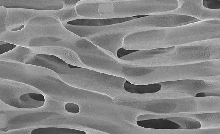 Abb.: Eine vergrößere Ansicht des Nano­schwamms: Die Poren haben einen...