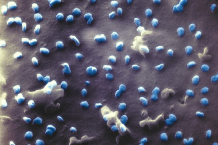 Abb.: Coronaviren (blau) beim Austritt aus einer Nierenzelle, aufgenommen mit...