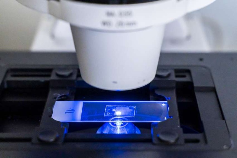 Abb.: Mit einem Fluores­zenz-Mikro­skop werden ein­zelne lebende Zellen nach...