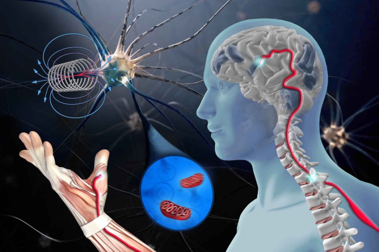Abb.: Gestörte Motoneuronen von ALS-Patienten werden mit magnetischen Impulsen...