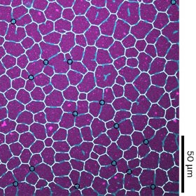 Henrik Weyer, Tobias A. Roth, Erwin Frey: Protein pattern morphology and dynamics emerging from effective interfacial tension. Nature Physics 2025