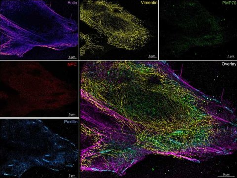 Multiplexe-Superauflösungsmikroskopie-Aufnahme von verschiedenen Proteinen (kleine Bilder) innerhalb einer Knochentumorzelle (U-2-OS-Zelllinie), aufgezeichnet mit dem neuen Mikrofluidik-System. Die Proteine sind mit eingefärbter DNA markiert. Sie werden auf Nanometer genau lokalisiert und alle gemeinsam dargestellt, um ein endgültiges Bild (großes Bild: Overlay) zu erstellen.