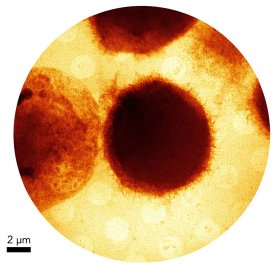 Mit dem L-TXM abgebildeten THP-1 Zelle